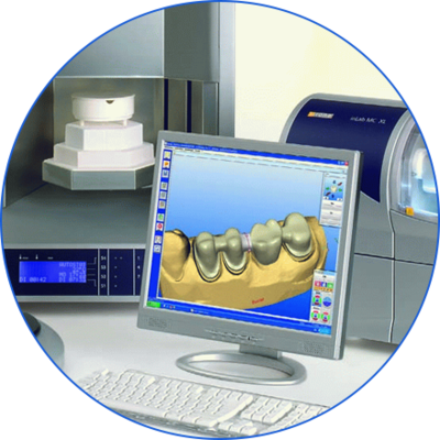 3D牙齒打印技術(shù)